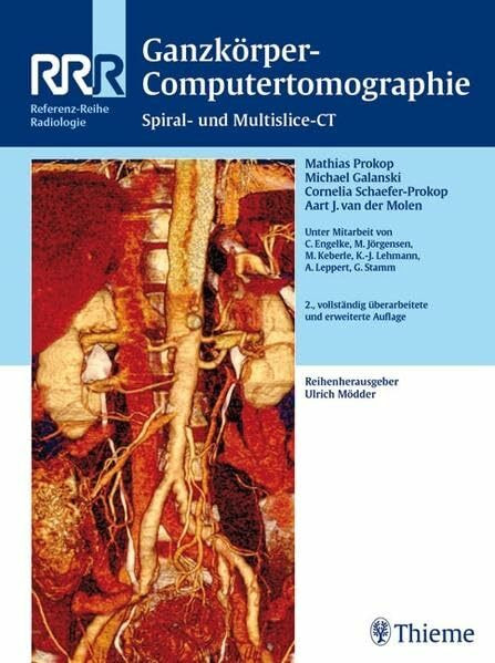 Ganzkörper-Computertomographie: Spiral- und Multislice-CT (Reihe, REF.-R. RADIOLOGIE)