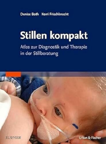 Stillen kompakt: Atlas zur Diagnostik und Therapie in der Stillberatung