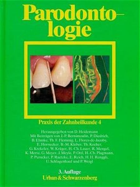 Praxis der Zahnheilkunde - PdZ. Strukturiert nach dem PermaNova-Verfahren: Praxis der Zahnheilkunde, 14 Bde. in 16 Tl.-Bdn., Bd.4, Parodontologie