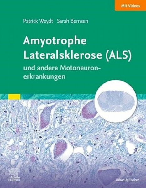 Amyotrophe Lateralsklerose (ALS) und andere Motoneuronerkrankungen: Das Wichtigste für Ärztinnen und Ärzte aller Fachrichtungen (Elsevier Essentials)