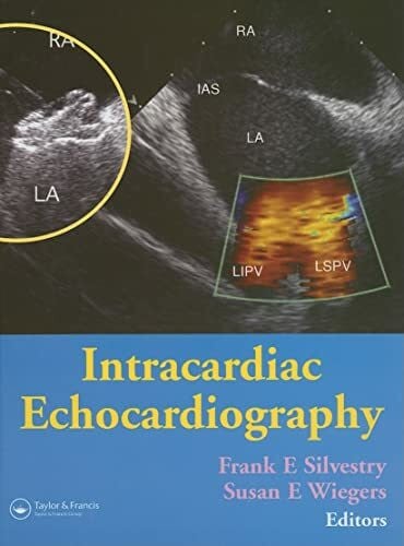 Intracardiac Echocardiography