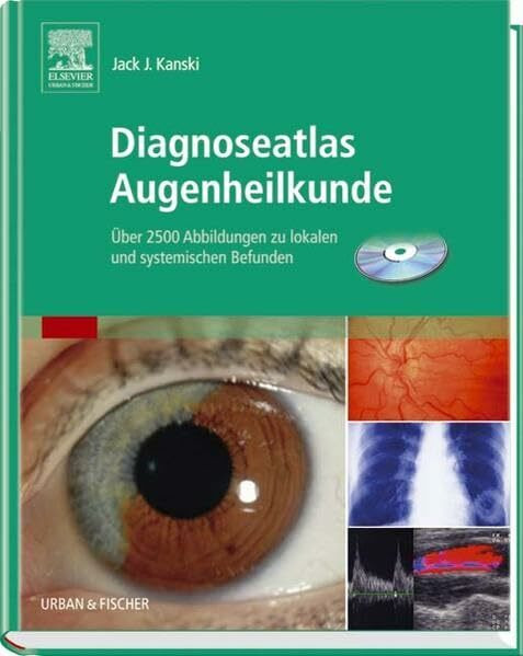 Diagnoseatlas Augenheilkunde: Über 2500 Abbildungen zu lokalen und systemischen Befunden