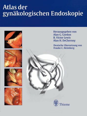 Atlas der gynäkologischen Endoskopie