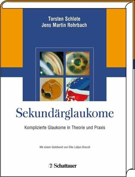 Sekundärglaukome: Komplizierte Glaukome in Theorie und Praxis