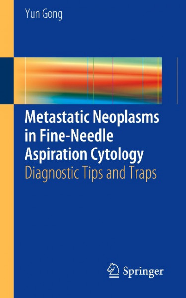 Metastatic Neoplasms in Fine-Needle Aspiration Cytology