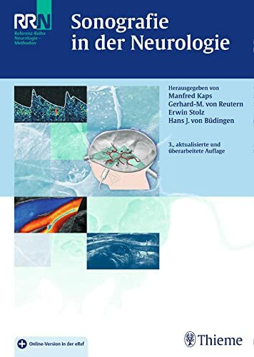 Sonografie in der Neurologie: Plus Online-Version in der eRef