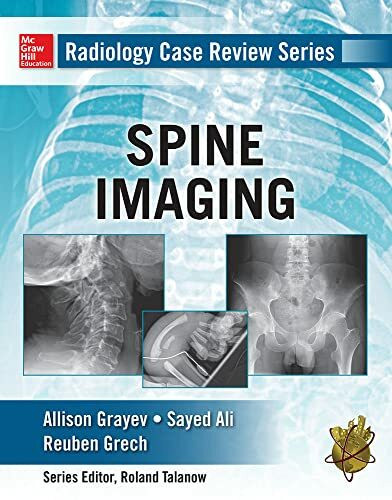 Mcgraw-Hill Professional Spine Imaging (Radiology Case Review)