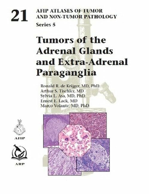 Tumors of the Adrenal Glands and Extra-Adrenal Paraganglia (AFIP Atlas of Tumor and Non-Tumor Pathology, Series 5, Band 21) Tumors of the Adrenal Glands and Extra-Adrenal Paraganglia (AFIP Atlas of Tumor and Non-Tumor Pathology, Series 5, Band 21)