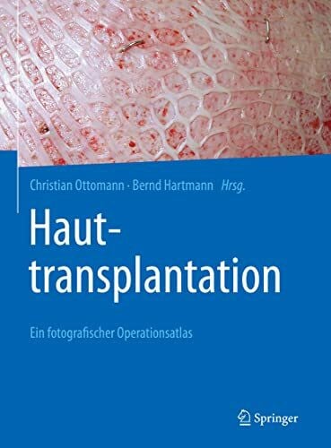 Hauttransplantation: Ein fotografischer Operationsatlas
