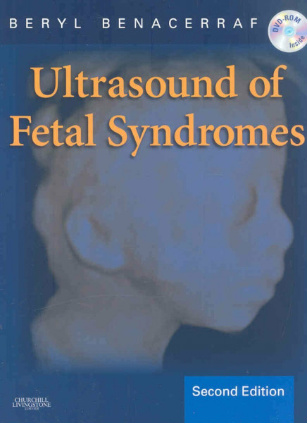 Ultrasound of Fetal Syndromes, w. DVD: Text with DVD