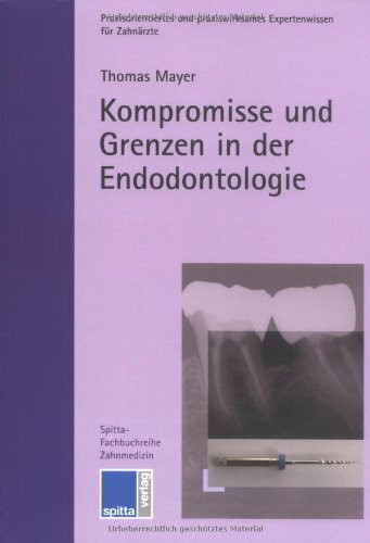 Kompromisse und Grenzen in der Endodontologie