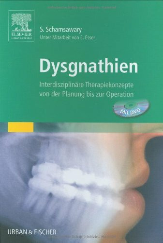 Dysgnathien & DVD: Interdisziplinäre Therapiekonzepte von der Planung bis zur Operation