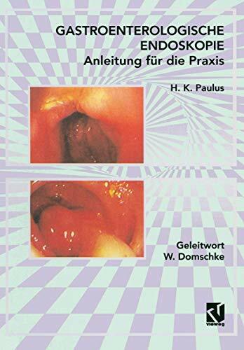 Gastroenterologische Endoskopie Anleitung für die Praxis Gastroenterologische Endoskopie Anleitung für die Praxis