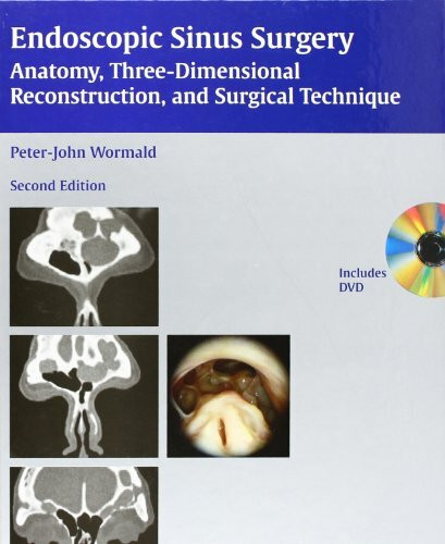 Endoscopic Sinus Surgery: Anatomy, Three-Dimensional Reconstruction, and Surgical Technique