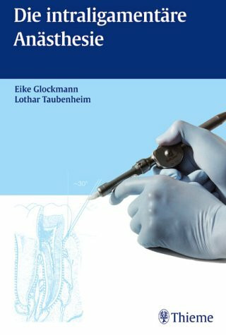 Die intraligamentäre Anästhesie (in der Zahnheilkunde)