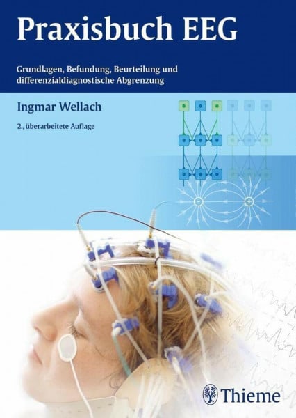 Praxisbuch EEG: Grundlagen, Befundung, Beurteilung und differenzialdiagnostische Abgrenzung