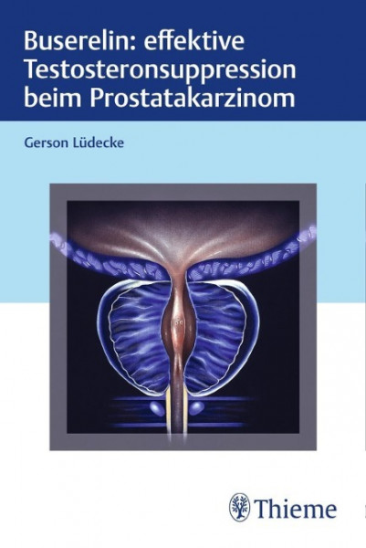 Buserelin: effektive Testosteronsuppression beim Prostatakarzinom