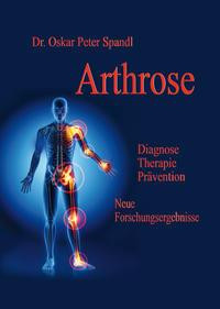 Arthrose