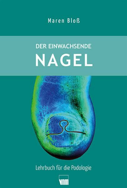 Der einwachsende Nagel