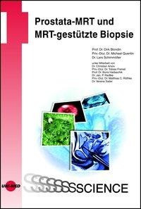 Prostata-MRT und MRT-gestützte Biopsie