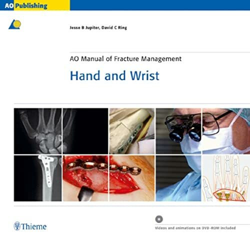 AO Manual of Fracture Management - Hand and Wrist (AO-Publishing)