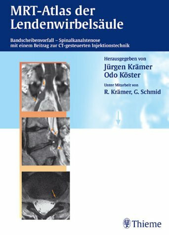 MR-Atlas der Lendenwirbelsäule. Bandscheibenvorfall - Spinalkanalstenose. Mit einem Beitrag zur CT-gesteuerten Injektionstechnik