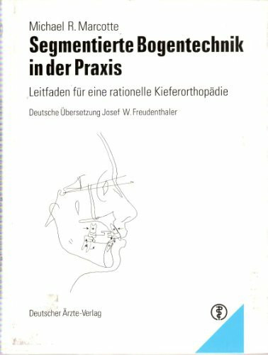 Segmentierte Bogentechnik in der Praxis: Leitfaden für eine rationelle Kieferorthopädie