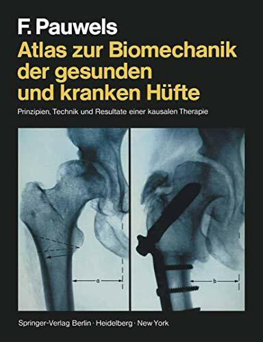 Atlas zur Biomechanik der gesunden und kranken Hüfte: Prinzipien, Technik und Resultate einer kausalen Therapie