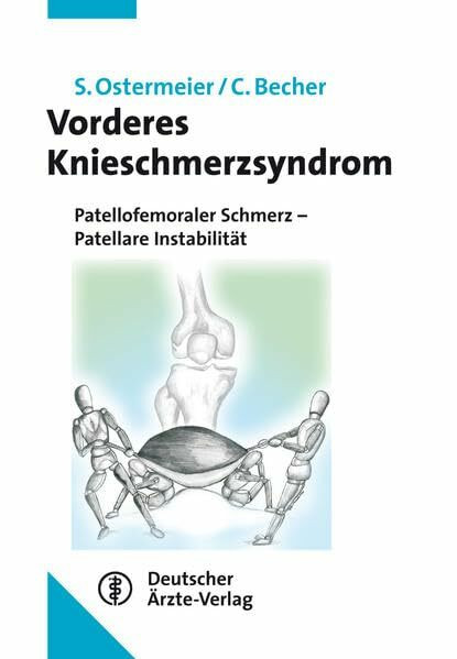 Vorderes Knieschmerzsyndrom: Patellofemoraler Schmerz - Patellare Instabilität