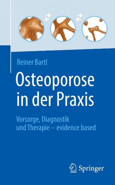 Osteoporose in der Praxis