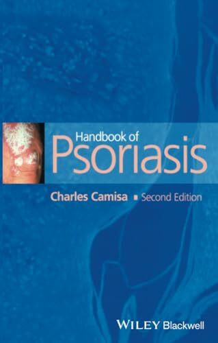 Wiley-Blackwell Handbook Of Psoriasis