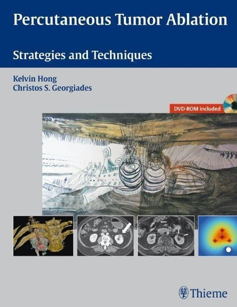 Percutaneous Tumor Ablation: Strategies and Techniques