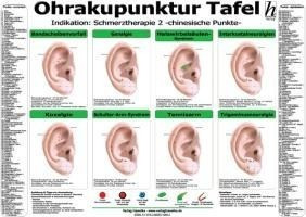 Ohrakupunktur Tafel - Indikation: Schmerztherapie 2