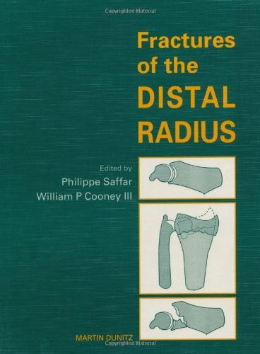 Fractures Of The Distal Radius