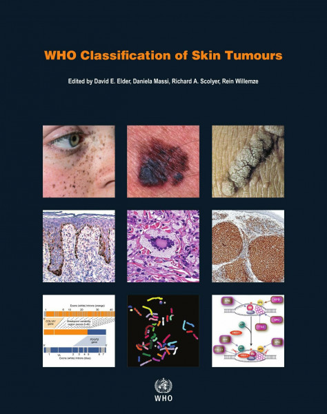 Who Classification of Skin Tumours: WHO Classification of Tumours, Volume 11 (Who Classification of Tumours: International Agency for Research on Cancer, Band 11)