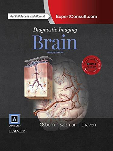 Diagnostic Imaging: Brain: ExpertConsult.com Diagnostic Imaging: Brain: ExpertConsult.com