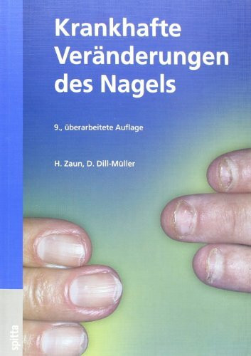 Krankhafte Veränderungen des Nagels