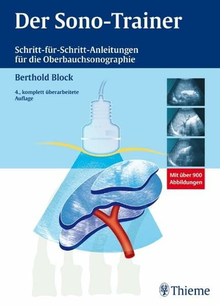 Der Sono-Trainer: Schritt für Schritt-Anleitungen für die Oberbauchsonographie