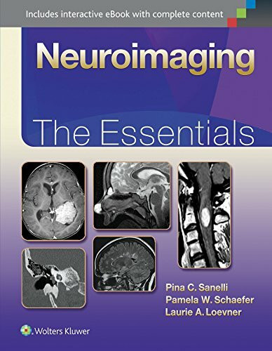 Neuroimaging: The Essentials (Essentials Series)