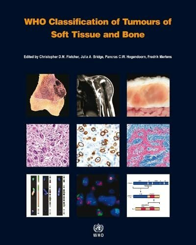 Who Classification of Tumours of Soft Tissue and Bone [op]