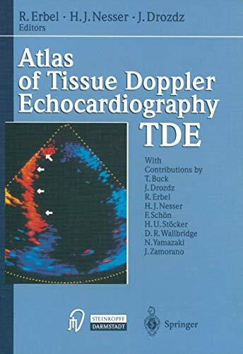 Atlas of Tissue Doppler Echocardiography TDE. With contributions by numerous experts