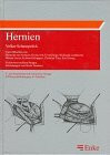 Hernien