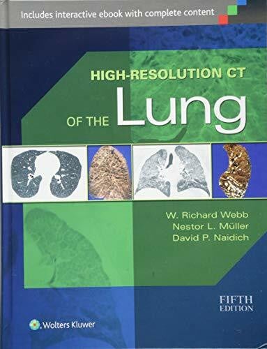 High-Resolution CT of the Lung