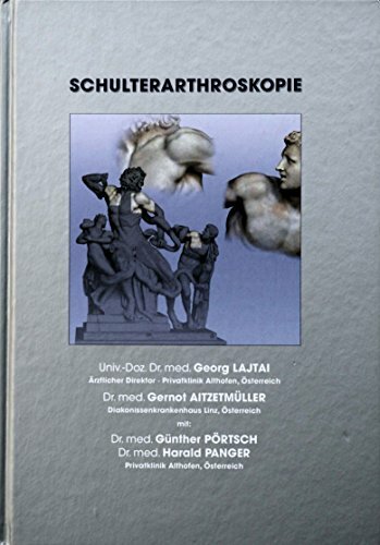 Schulterarthroskopie (Ärzte-Anleitungen /Fachgebiet Arthroskopie und Sportmedizin) Schulterarthroskopie (Ärzte-Anleitungen /Fachgebiet Arthroskopie und Sportmedizin)