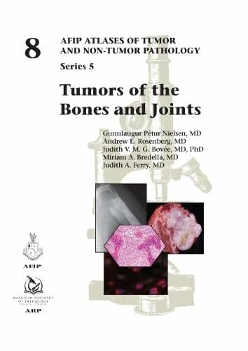 Tumors of the Bones and Joints (AFIP Atlases of Tumor and Non-tumor Pathology, Series 5, Band 8)