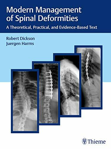 Modern Management of Spinal Deformities: A Theoretical, Practical, and Evidence-Based Text