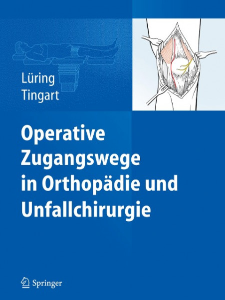 Operative Zugangswege in Orthopädie und Unfallchirurgie