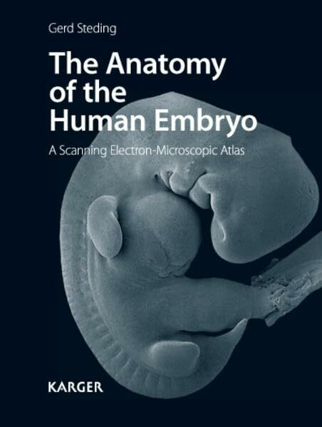 The Anatomy of the Human Embryo: A Scanning Electron-Microscopic Atlas.