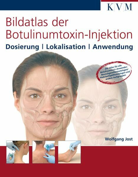 Bildatlas der Botulinumtoxin-Injektion: Dosierung / Lokalisation / Anwendung