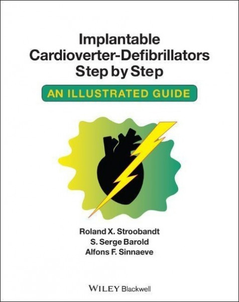 Implantable Cardioverter - Defibrillators Step by Step - An Illustrated Guide